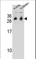 CYB561D1 Antibody (aa200-229)