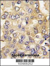 Polyclonal Rabbit anti-Human PFKM / PFK-1 Antibody (aa746-776, IHC, IF, WB)