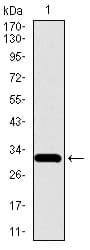 SLC27A5 / BACS Antibody (aa508-570, clone 4B11C10)