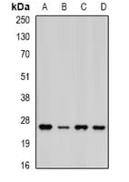 Polyclonal Rabbit anti-Human PSMA5 Antibody (IF, WB)