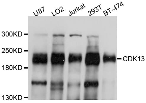 IHC-plus™ CDK13 / CDC2L5 Antibody
