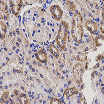 Polyclonal Rabbit anti-Human EPHX2 / Epoxide Hydrolase 2 Antibody (IHC, WB)