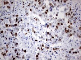 MKI67 / Ki67 Antibody (aa1160-1493, clone OTI15A4)