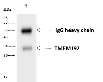 Polyclonal Rabbit anti-Human TMEM192 Antibody (IHC, IF, WB)