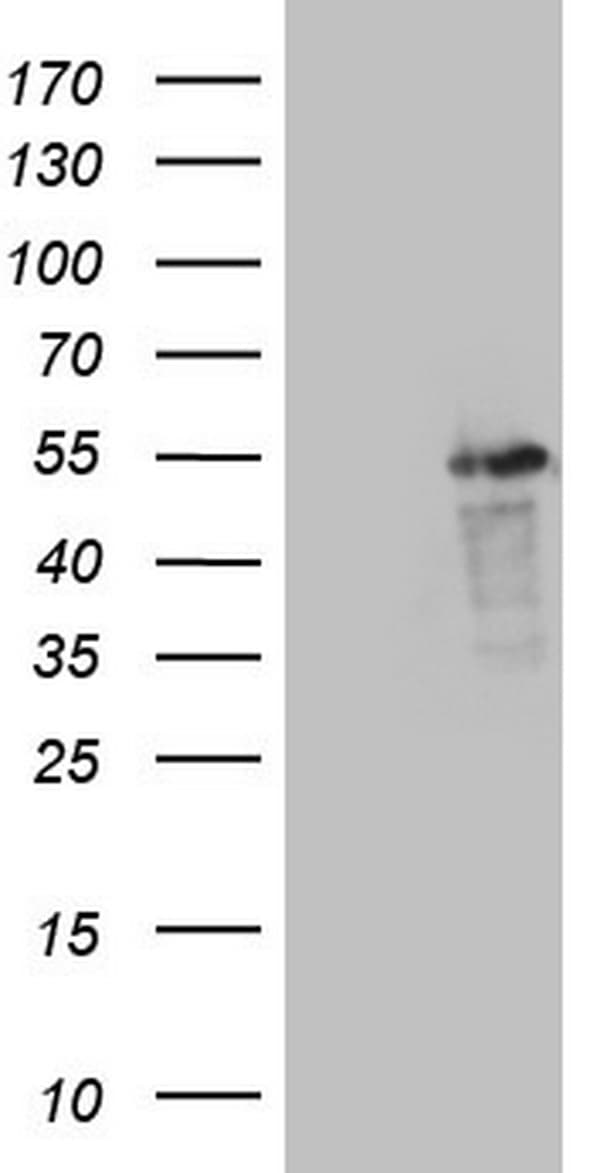 LRRC6 Antibody (clone OTI2E4, Carrier-free)