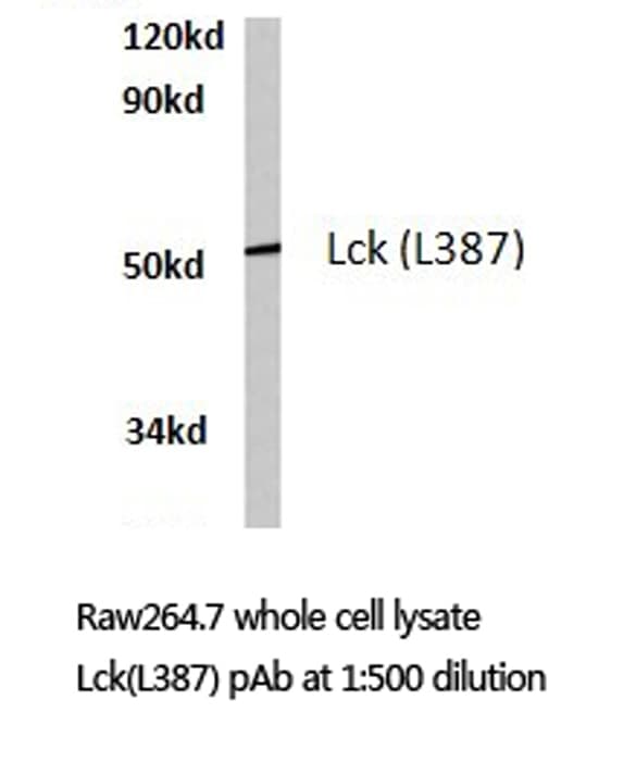 p56lck / LCK Antibody (Leu387)