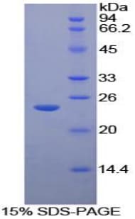 Human GLB1 / Beta-Galactosidase Protein (Recombinant His-S)