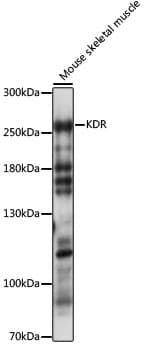 KDR / VEGFR2 / FLK1 Antibody