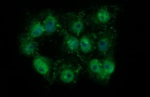 TH / Tyrosine Hydroxylase Antibody (clone OTI2D4)