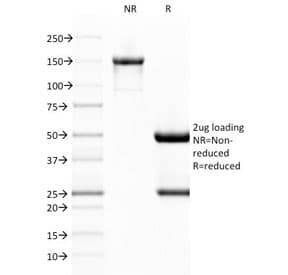 VWF / Von Willebrand Factor Antibody (clone VWF/1767, Azide-free, BSA-free)