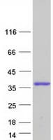 Human DBNDD2 Protein (Recombinant Myc-DDK (Flag))