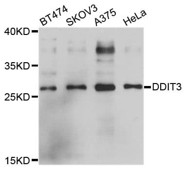 Polyclonal Rabbit anti-Human DDIT3 / CHOP Antibody (IHC, WB)
