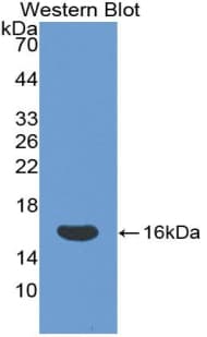 NK1 / CD160 Antibody (aa37-154, PE)