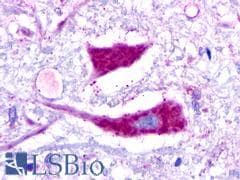 PathPlus™ GALR3 / Galanin Receptor 3 Antibody (Cytoplasmic Domain)