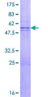 Human TMEM123 / Porimin Protein (Recombinant GST)