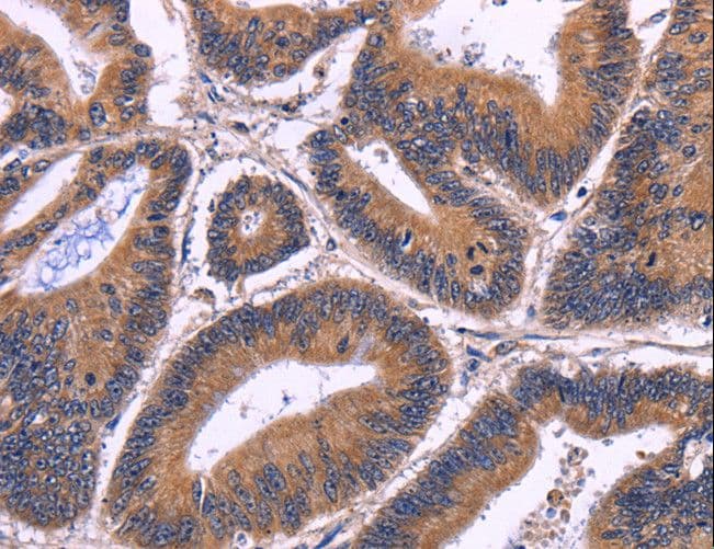 Polyclonal Rabbit anti-Human LCA3 / SPATA7 Antibody (IHC)