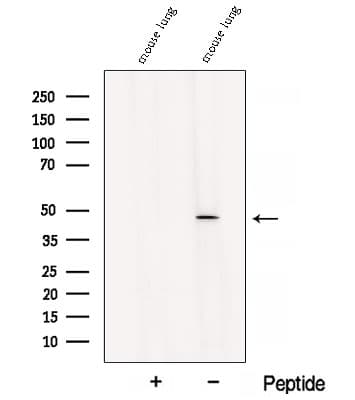 B3GNT3 / TMEM3 Antibody