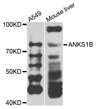 Polyclonal Rabbit anti-Human ANKS1B Antibody (IHC, WB)