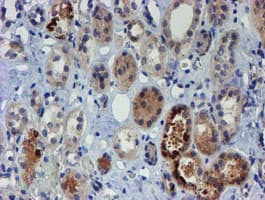 PGM3 Antibody (clone OTI1A11)