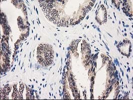 GALE / UDP-Glucose 4-Epimerase Antibody (clone OTI1C4)