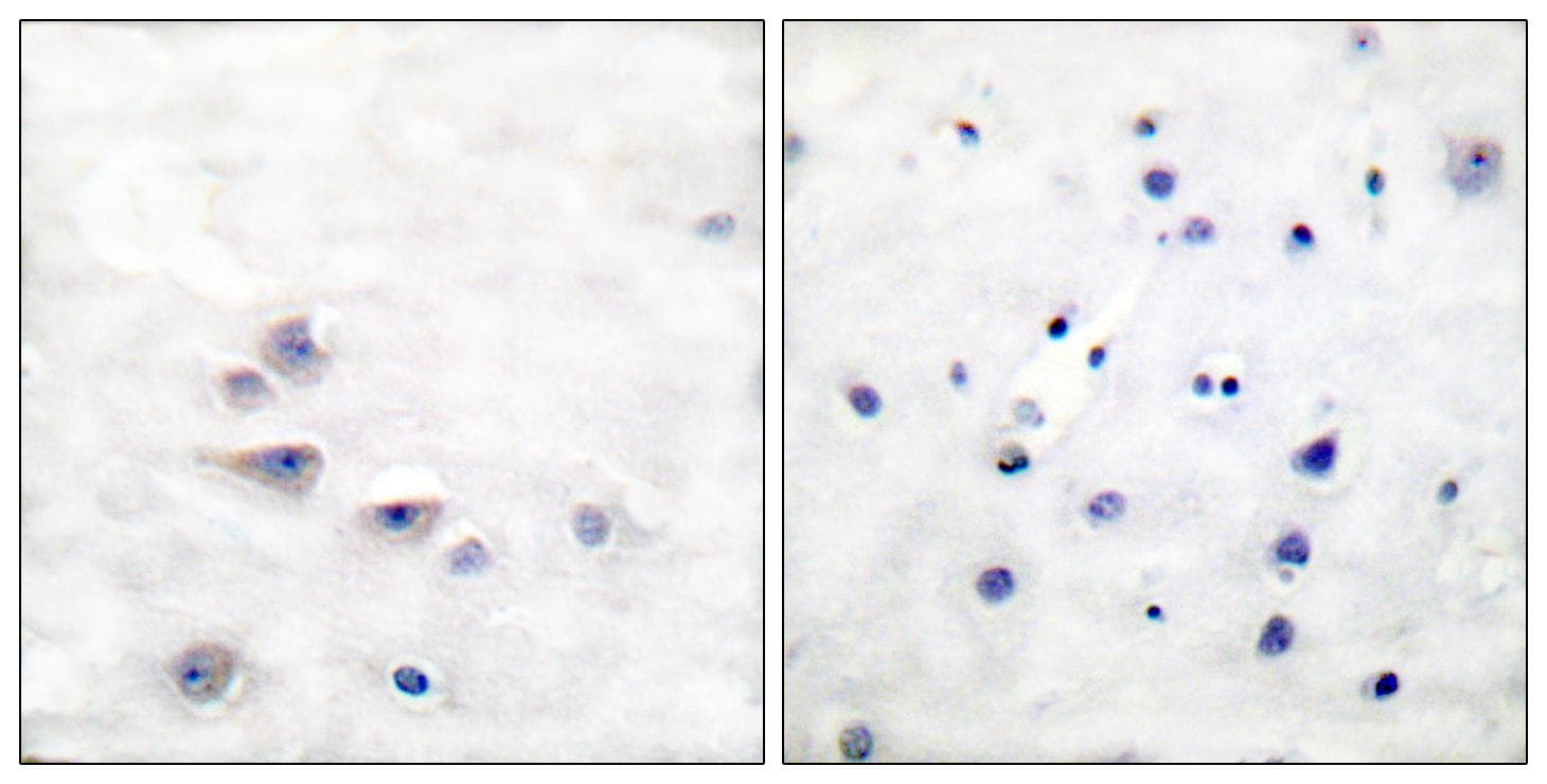 p66 / SHC Antibody (phospho-Tyr427)