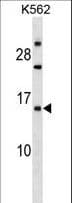 IHC-plus™ EMP1 Antibody (aa35-63)