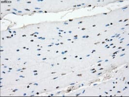 CRYAB / Alpha B Crystallin Antibody (clone OTI6G5)