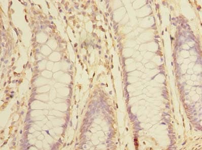SNX16 Antibody