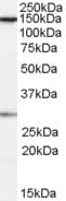 IHC-plus™ Polyclonal Goat anti-Human SUPT16H / FACTP140 Antibody (aa385-397, IHC, WB)