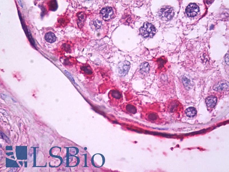 IHC-plus™ Polyclonal Rabbit anti-Human UCN / Urocortin Antibody (aa71-120, IHC)