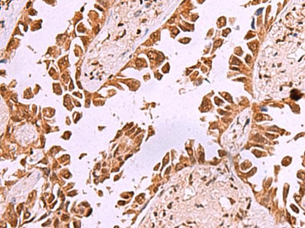 IRX1 Antibody