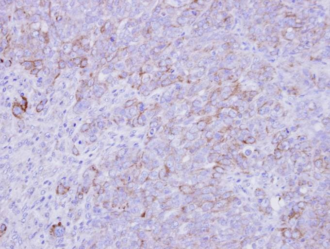 Polyclonal Rabbit anti-Human SLC26A8 / TAT1 Antibody (aa613-850, IHC, WB)