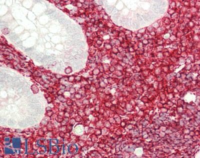 IHC-plus™ CD45 / LCA Antibody (clone 4C11)