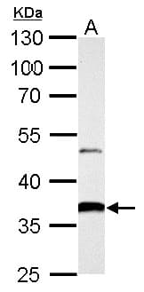 IHC-plus™ AKR1B10 Antibody (aa1-316)