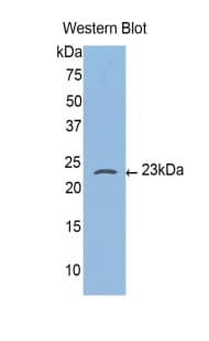 CASP4 / Caspase 4 Antibody (aa81-266, Biotin)