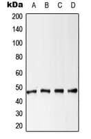 Polyclonal Rabbit anti-Human KRT18 / CK18 / Cytokeratin 18 Antibody (phospho-Ser52, WB)