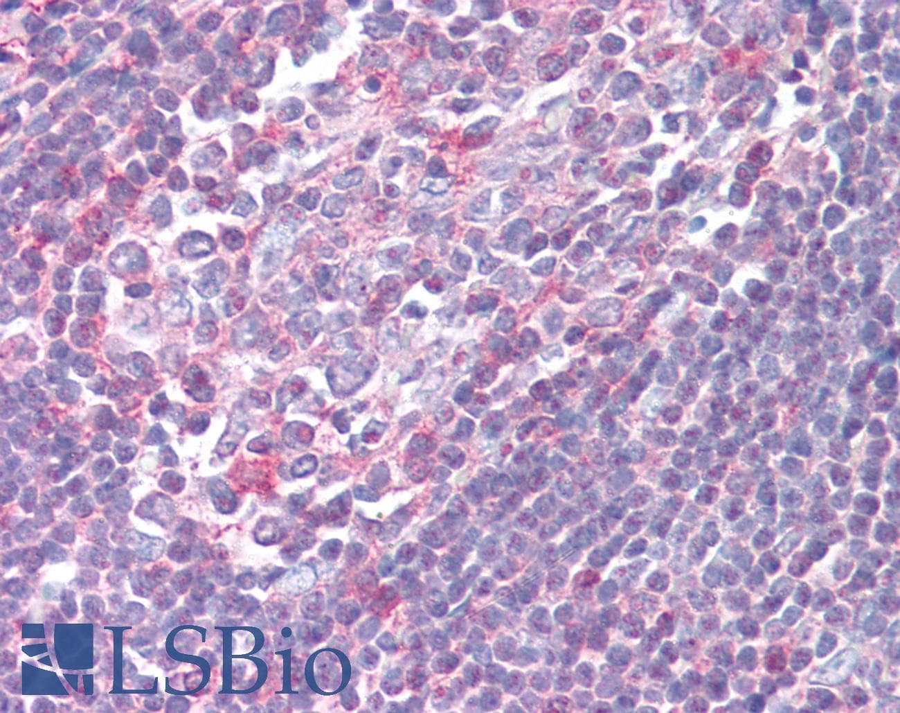 IHC-plus™ XCR1 Antibody (Cytoplasmic Domain)