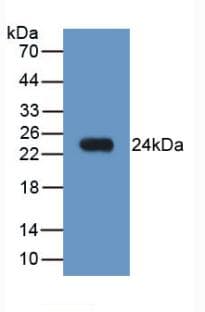 LCN2 / Lipocalin 2 / NGAL Antibody (PE)