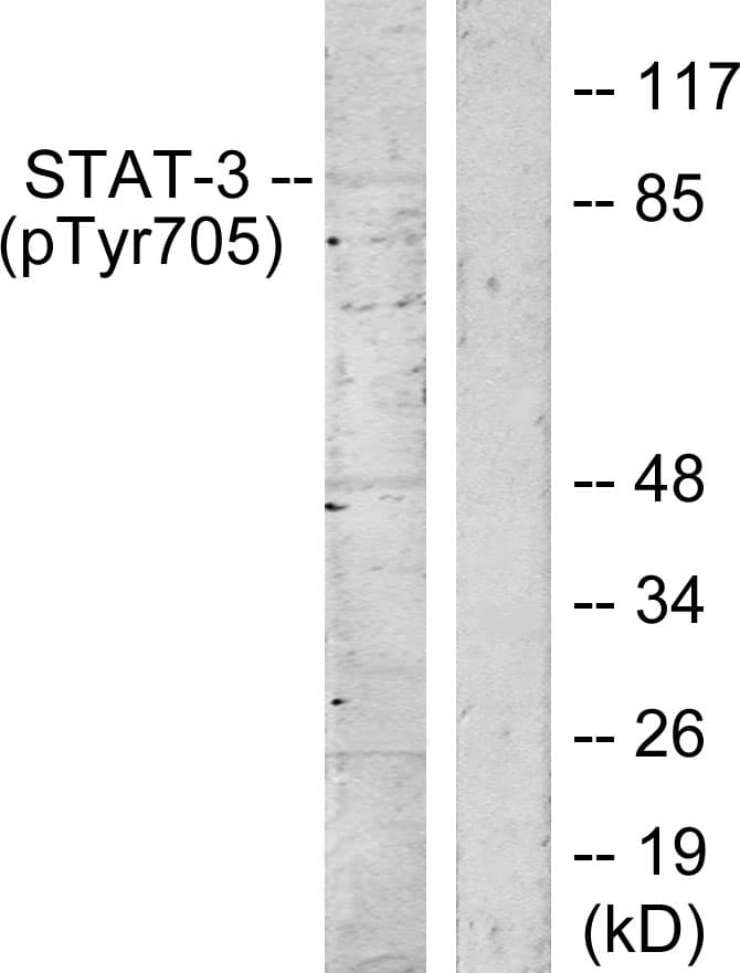 Polyclonal Rabbit anti-Human STAT3 Antibody (phospho-Tyr705, IHC, WB)
