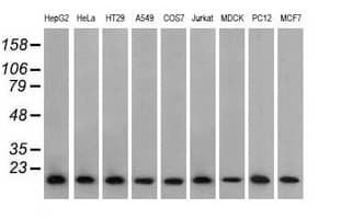 Monoclonal Mouse anti-Human PFN1 / Profilin 1 Antibody (clone OTI1D5, IHC, IF, WB)