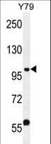 PHF20 Antibody (aa123-151)