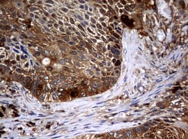 NME1 / NM23 Antibody (clone OTI7F6)