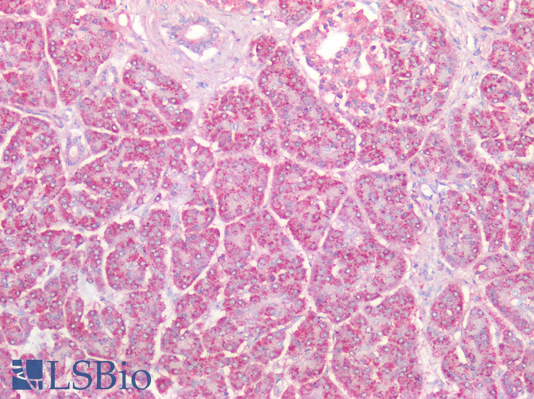 PathPlus™ HSPD1 / HSP60 Antibody