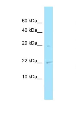 CHMP2A Antibody (N-Terminus)