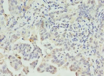 CLEC1A / CLEC-1 Antibody