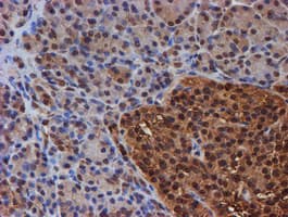 PSMB9 Antibody (clone OTI3F3)
