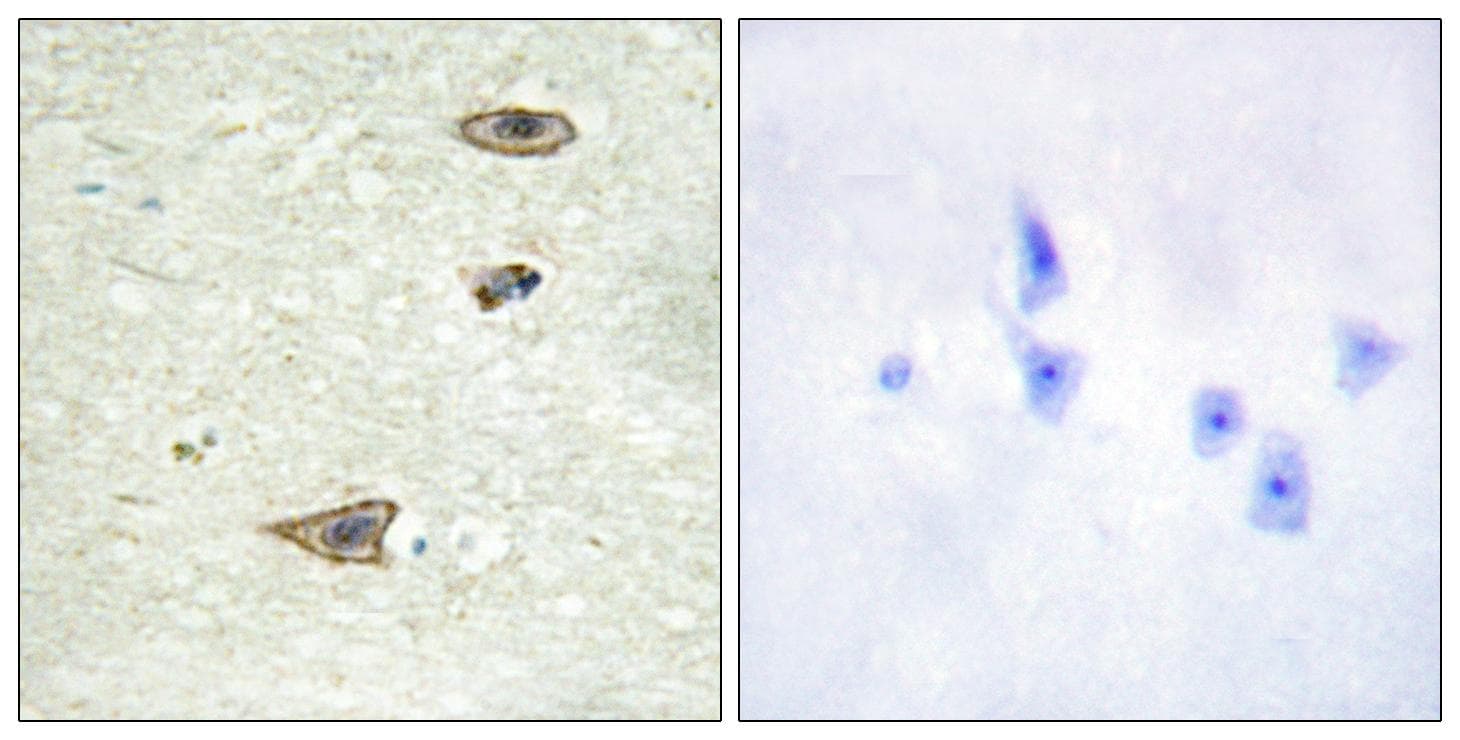 Rhodopsin Kinase / GRK1 Antibody (p21)