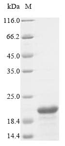 Bovine FDX1 / ADX Protein (Recombinant 10His, N-terminus)