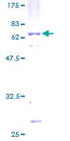 Human MAT2B Protein (Recombinant GST)