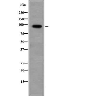 Polyclonal Rabbit anti-Human PPP1R10 / PNUTS Antibody (WB)